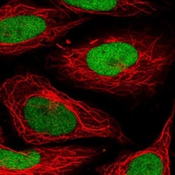 SET Antibody, Novus Biologicals:Antibodies:Primary Antibodies